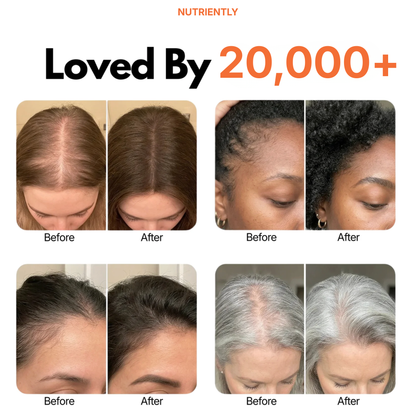 Growturn Hair Growth Serum