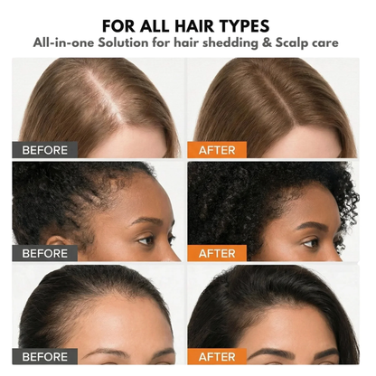 Growturn Hair Growth Serum